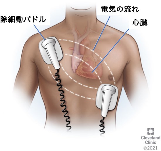 心臓ペースメーカ・ICD当院で行う治療・検査診療案内心臓病センター榊原病院