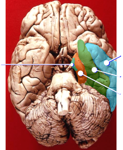 口の中の病気 舌の病気舌痛症など 新宿の歯医者赤羽歯科新宿診療所