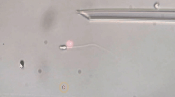 体外受精不妊治療- 静岡県沼津・三島 産婦人科・不妊治療の岩端医院