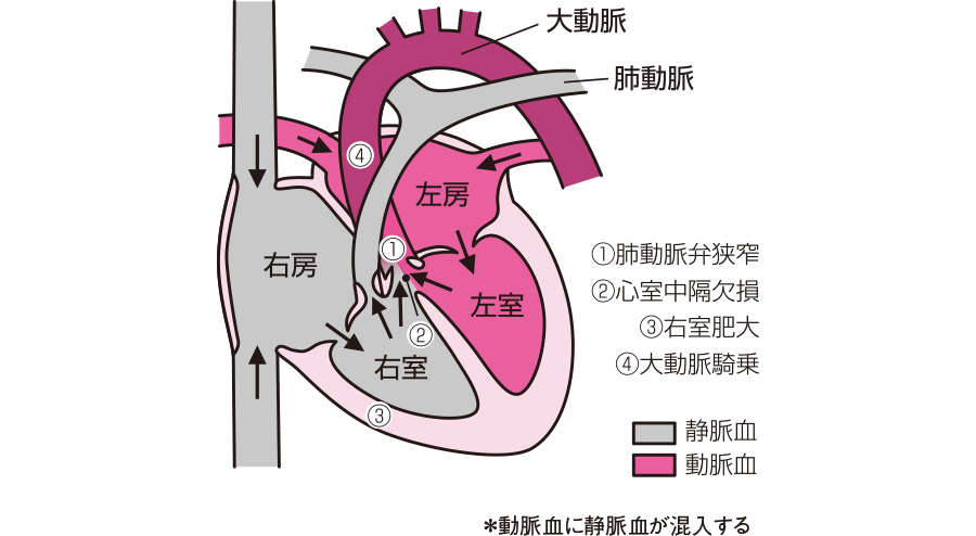 心不全ってどんな症状？原因となる7つの病気 – いしゃまち
