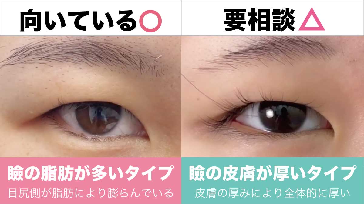 @nae_070に返信 痩せたらまぶたのお肉がなくなった！！ ダイエット垢抜け垢抜け方法垢抜け日記おすすめおすすめにのりたいバズれバズりたい