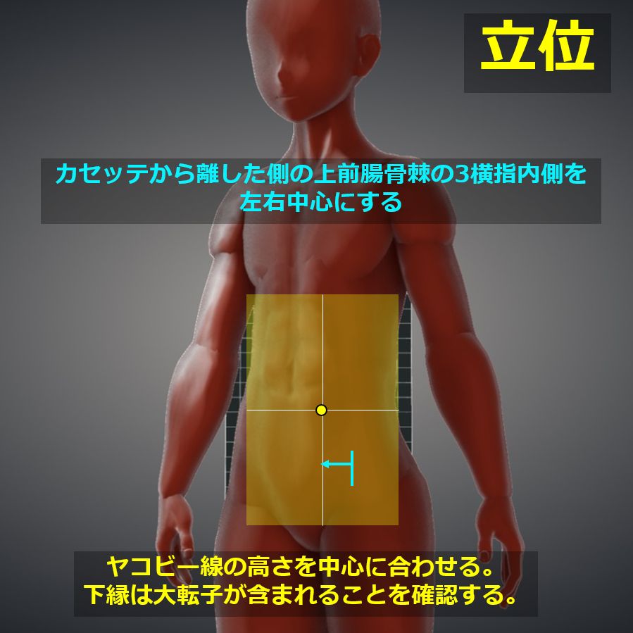 腰部のレントゲン検査について整体院-カイル-相模大野