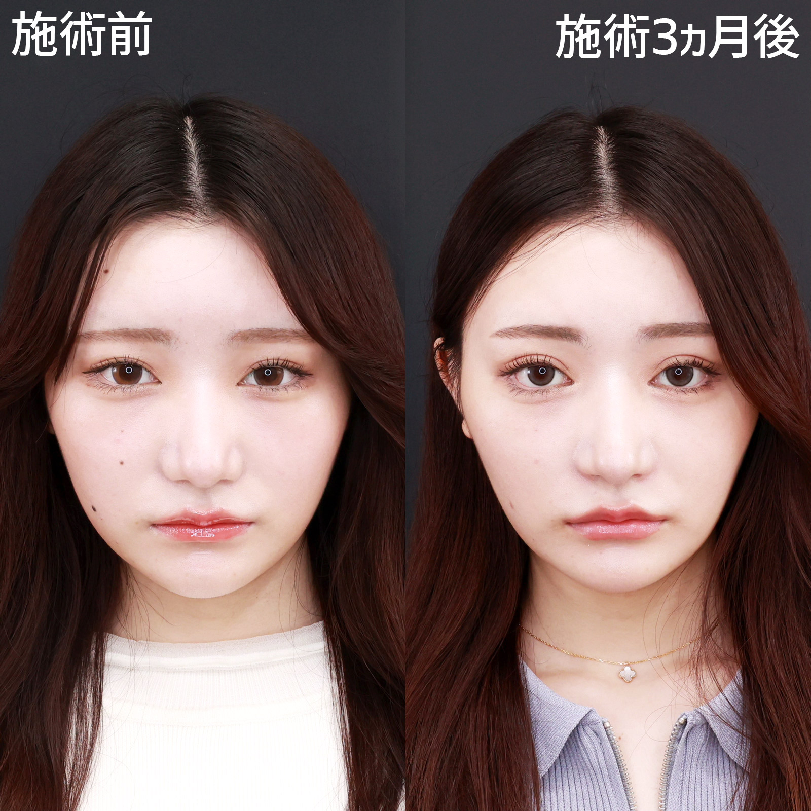 松田リマの頭の中🧠@_rima_tanoshiine_• Instagram photos and videos