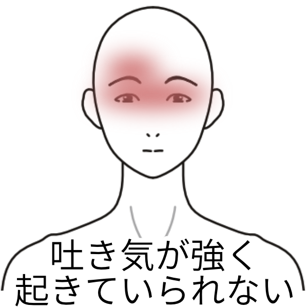 つらい片頭痛！ツボを使って毎日を楽に過ごそう！ - 漢方の知恵で、もっと健やかに美しく。Kampoful Life