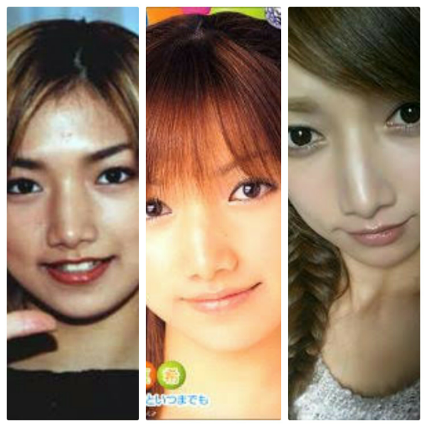 マキ・コニクソンさんのインスタグラムでご紹介いただきました。July2017 ハワイ アジアパシフィック美容整形外科