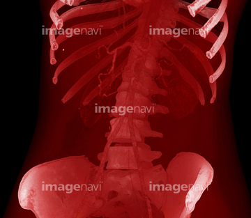 読影の実際胸部写真の読み方太田東こども＆おとな診療所こどもとおとなの病気について、気軽に相談できる診療所です