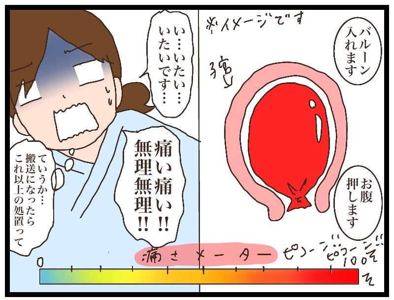 バルーン挿入後の痛みはどんな感じ？痛みを和らげる方法はある？kosodate LIFE 子育てライフ