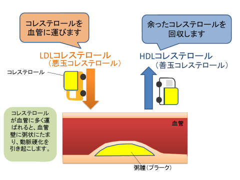 高脂血症・脂質異常症の違い国府クリニック