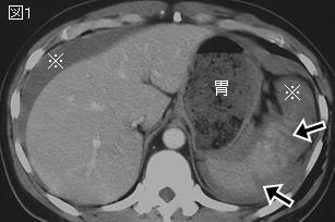 春日井市民病院外科の取組み