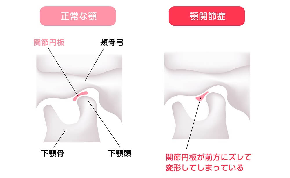 猫背の原因と姿勢矯正方法の紹介小石川整骨院あきらめていた痛みを根本治療する整体小伝馬町駅・春日駅すぐ
