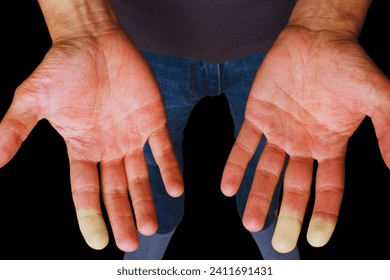 振動障害・じん肺東京都新宿区の建交労なら全日本建設交運一般労働組合 全国労災職業病部会