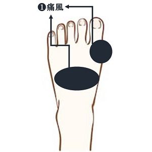 高尿酸血症・痛風まえの内科クリニック