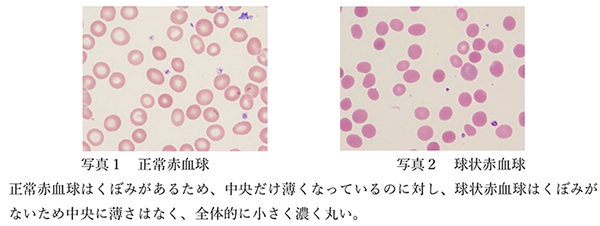 犬の貧血に効果的な食事は？原因や症状、おすすめの食べ物和漢・みらいのドッグフード公式ブログ