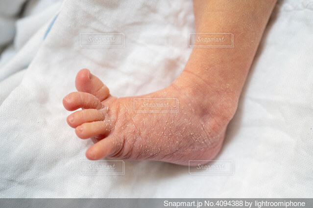 赤ちゃんの指の皮むけと指しゃぶりTikTok