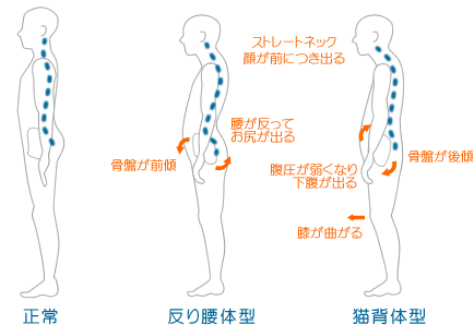 ストレートネック解消のために - ＫＣＳセンター たかの施術院