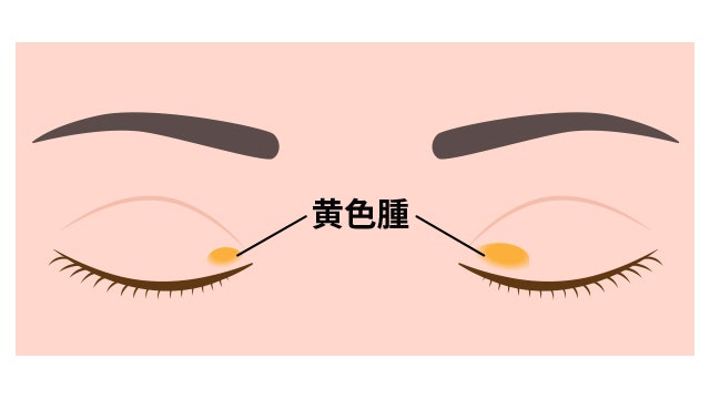 北海道心臓協会