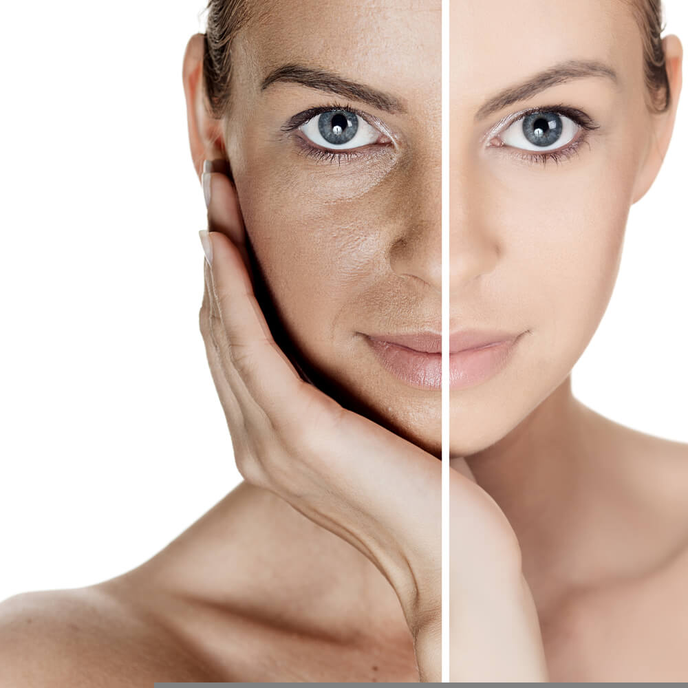 シミ・色素沈着の除去美容外科・美容皮膚科・形成外科 共立美容外科仙台院