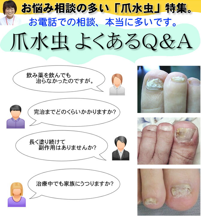 医師監修 水虫予防のための11の予防策！靴の選び方や水洗いなど徹底解説！セイムスコラムドラッグセイムス富士薬品のドラッグストア・薬局