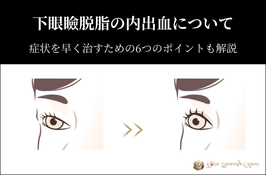 目の周りの内出血を早く治す方法を徹底解説!公式 ASTRA BEAUTYCLINIC アストラビューティクリニック 美容外科・美容皮膚科・形成外科渋谷駅前