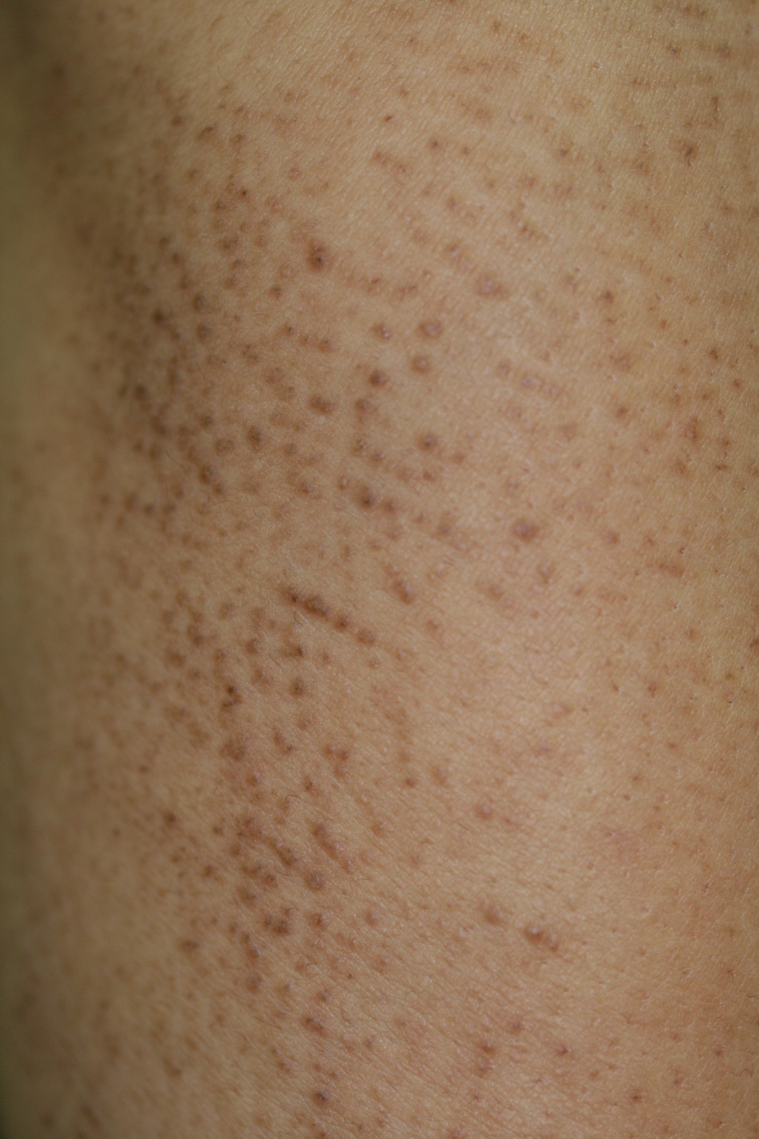 キズカイン丹平製薬株式会社