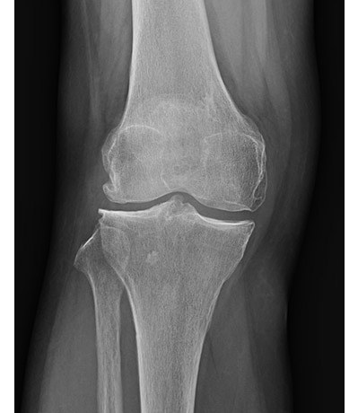 女性の下半身の X 線 - 3Dのストックフォトや画像を多数ご用意 - 3D, 3Dスキャン, X線撮影 - iStock