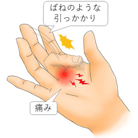 手のしびれ府中市 あかつき療法院
