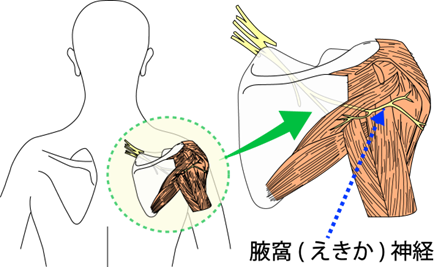 寝違えの原因とその対処法をプロの視点から探る東京駅の整形外科 竹谷内医院