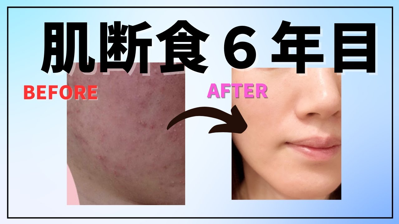 角質培養経過もやもやブログ