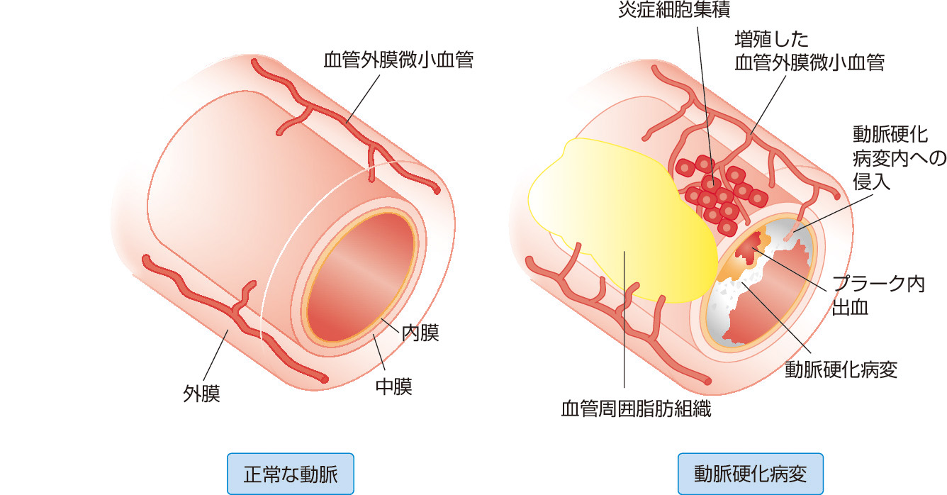 胃隆起性病変とは？ たまプラーザ南口胃腸内科クリニック 消化器内視鏡横浜青葉区院