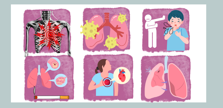 全日本民医連けんこう教室 胸が痛いんです