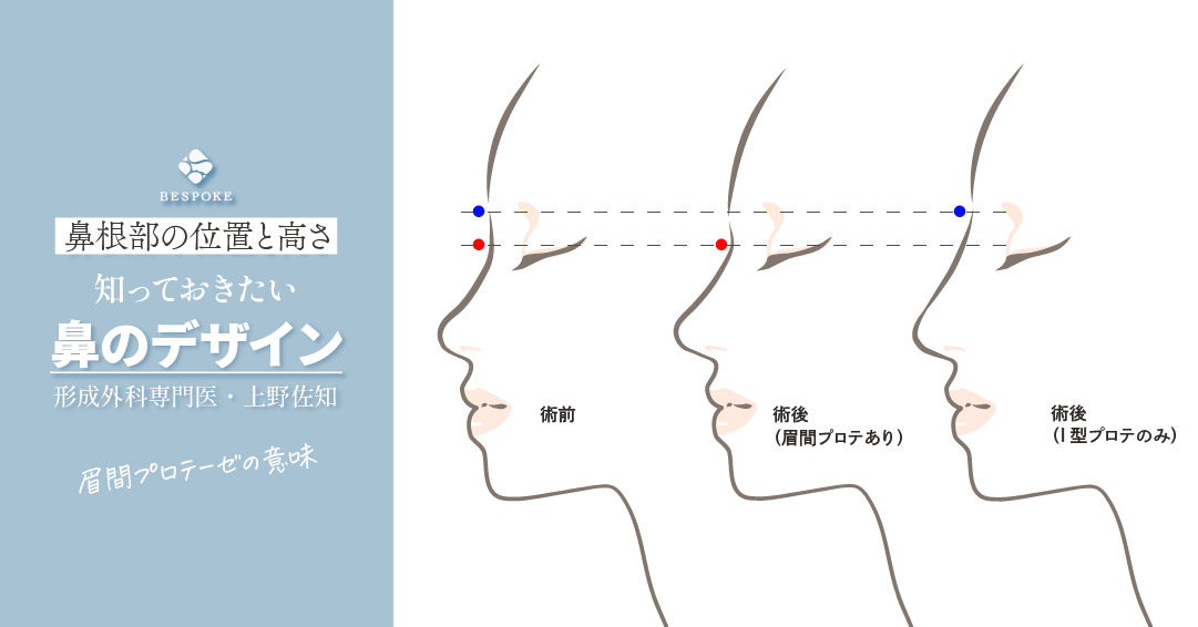 眉間のしわを改善したい！医師に聞く、本当の原因と正しい対策美容知識コラムアラガン・エステティックス・ビューティ