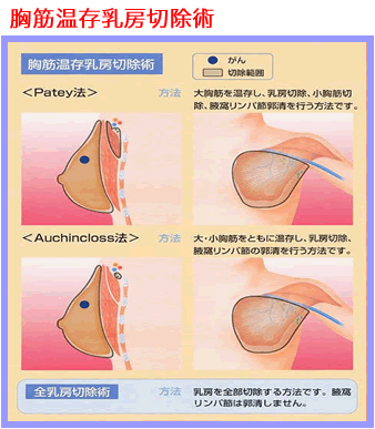 よくあるご質問 乳がん 福岡大学医学部呼吸器外科