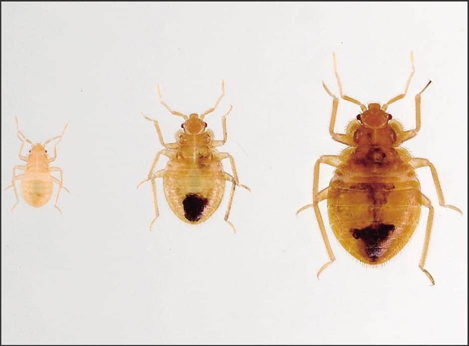 かゆくてかゆくて耐えられない」 トコジラミ被害、北海道でもじわじわ増殖中＜デジタル発＞：北海道新聞デジタル