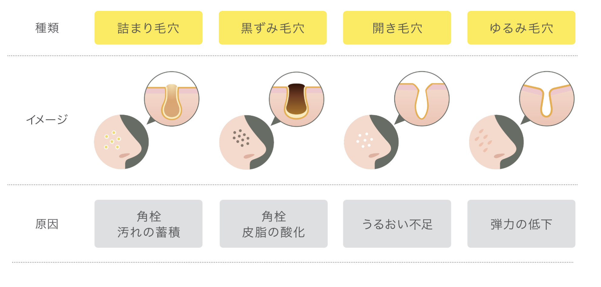 押し出し厳禁 角栓の取り方とは？毛穴につまった角栓の原因や対処・治療法を徹底解説 - OZmall