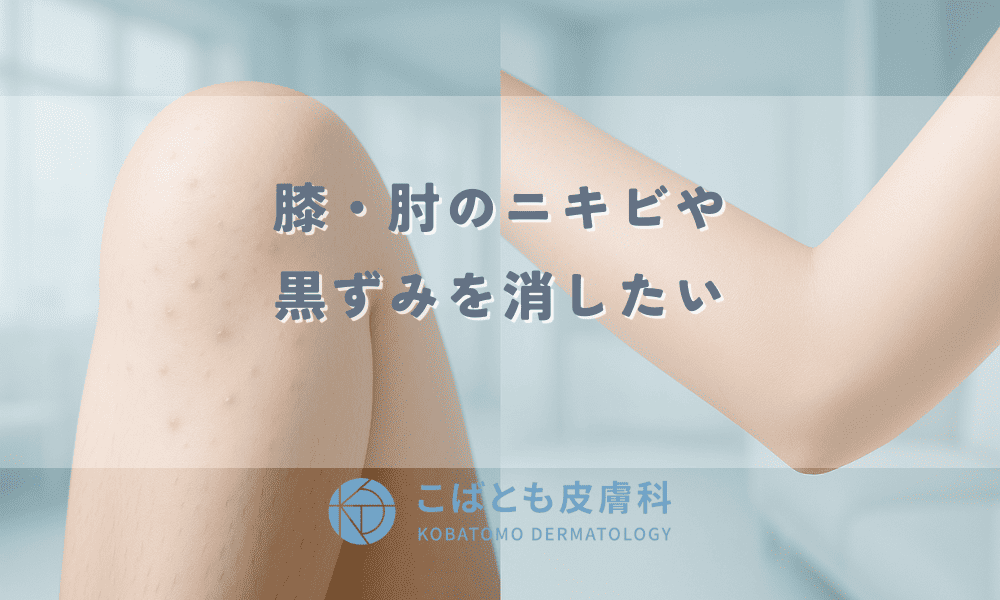 重曹で肘・膝の黒ずみを取ることはできるの？方法や注意点について解説チュラコスの美活予備校