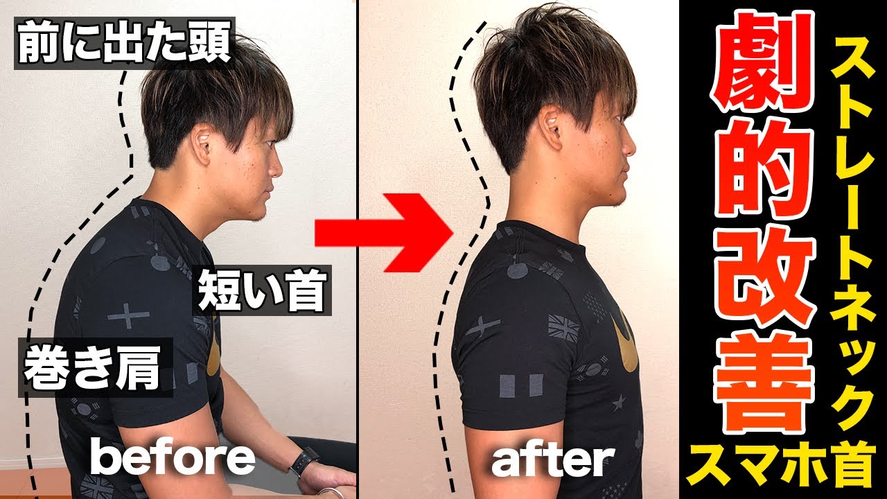 ストレートネックの症状改善の流れ