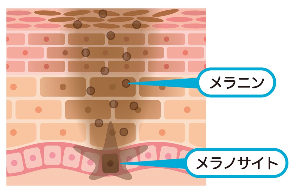 38から41までに掲げるもののほか、慢性副腎皮質機能低下症 アジソン Addison 病を含む。診断の手引き - 小児慢性特定疾病情報センタ