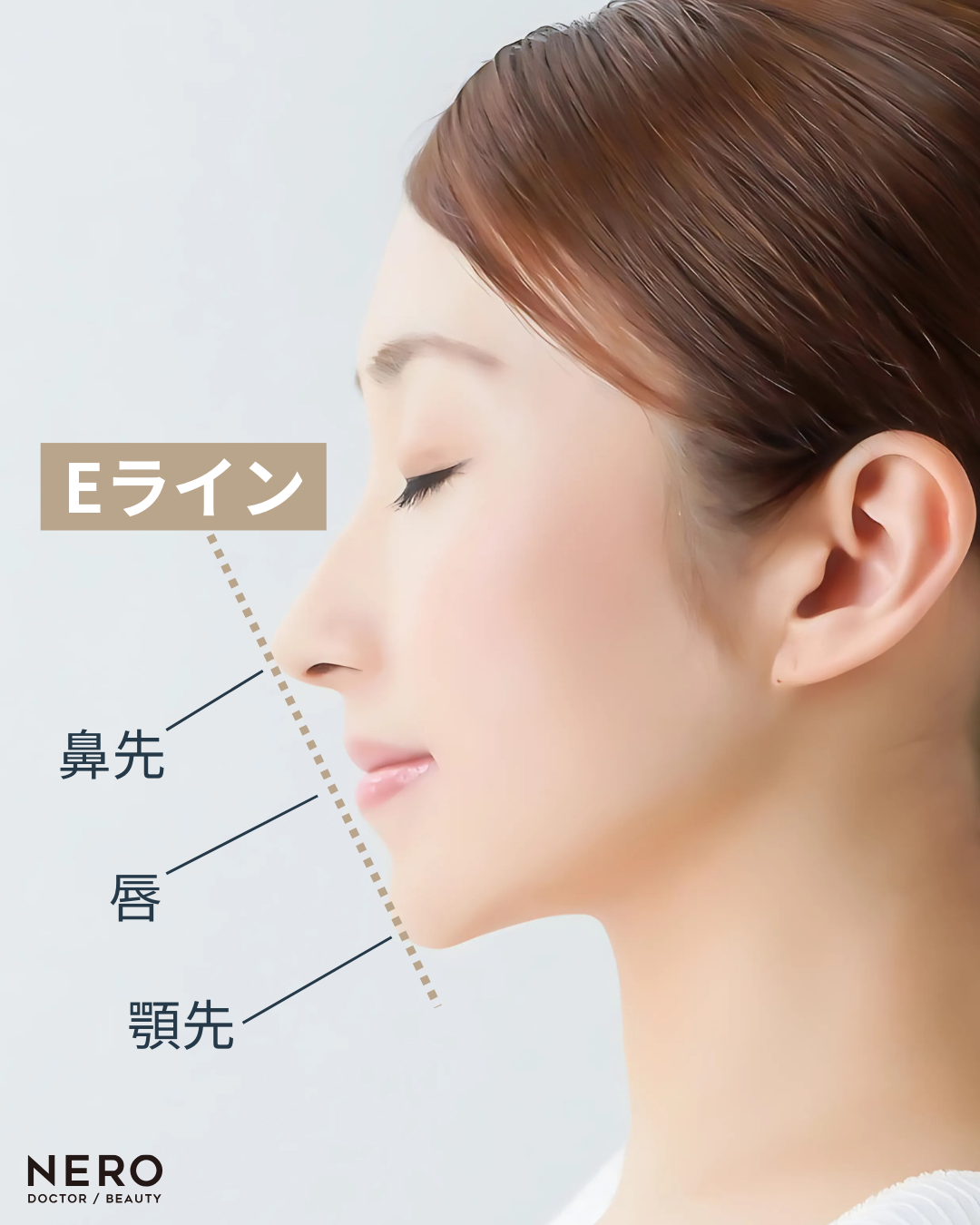 横顔が平たいお悩みの方必見！効果的な美容整形と症例写真を紹介 - WOMクリニック銀座