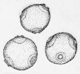 花粉症の私 りんごが食べられなくなりましたNHKニュース