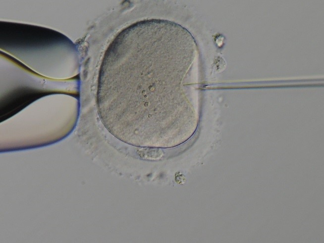 体外受精の流れはなおかIVFクリニック品川JR大崎駅徒歩90秒不妊治療、体外受精専門クリニック