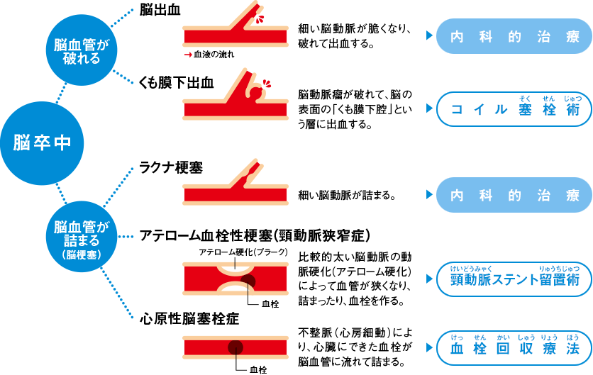 ライス・エムボリ