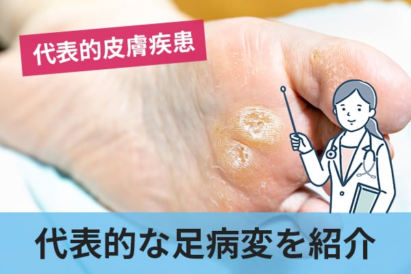 帯状疱疹の症状、原因、治療、予防法について皮膚科専門医が徹底解説しますとも皮膚科クリニック高崎市の皮膚科・アレルギー科