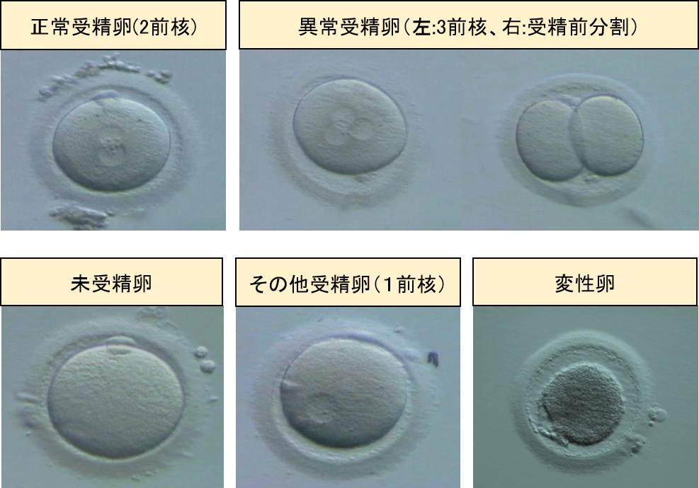 不妊治療愛媛県松山市の産婦人科矢野産婦人科