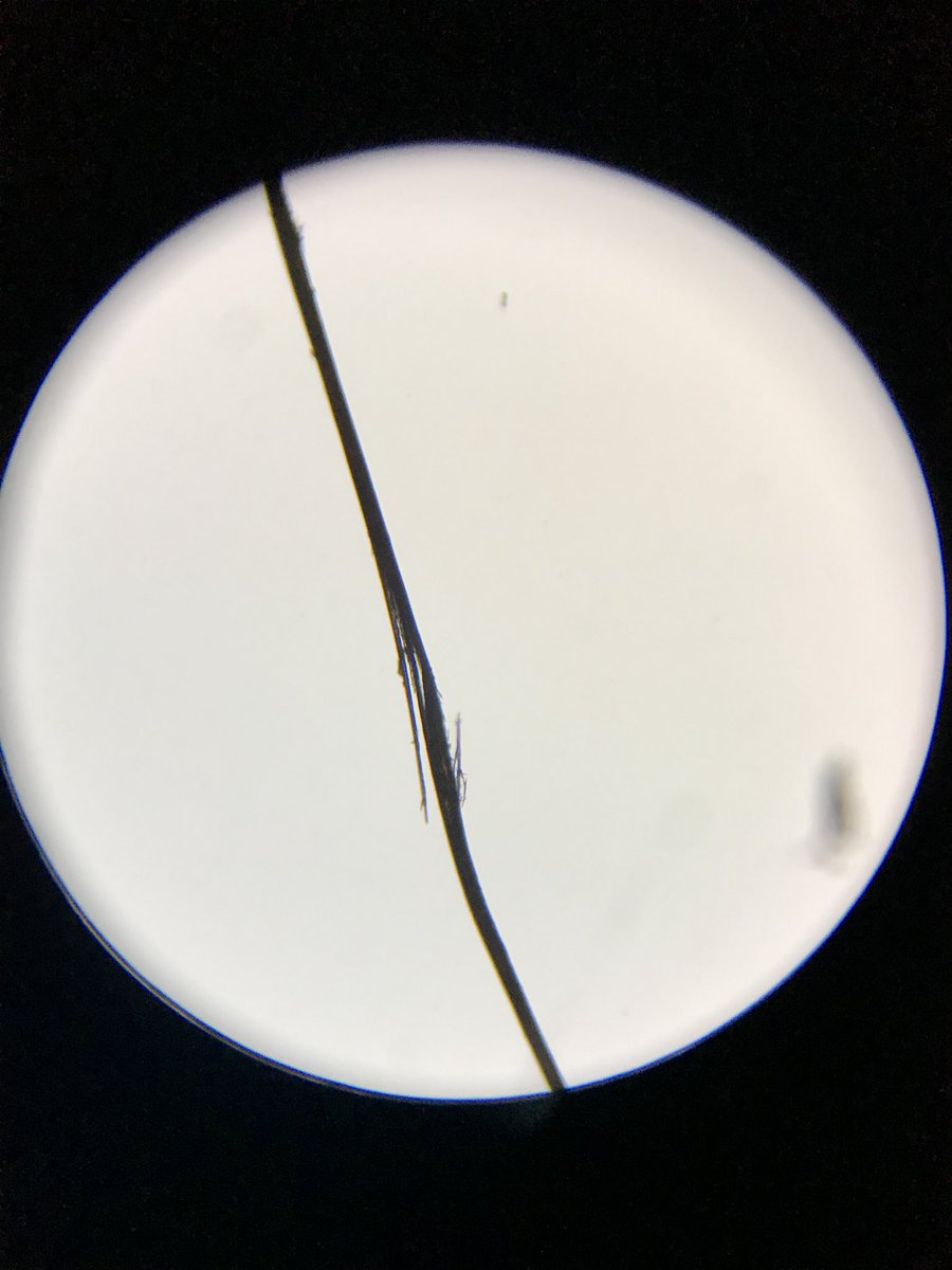 枝毛取りと歯医者の関連性についてTikTok