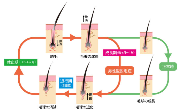 楽天市場サンプル付き 頭皮の美容液 薬用頭皮ケアトニックD100mL医薬部外品 +クレンジングジェルのオマケ付き スカルプトニックスカルプケア 育毛サイクル 薄毛 かゆみ 脱毛の予防 発毛促進 ふけ 病後産後 ぬけ毛 美髪 地肌の健康 頭皮環境 毛量 女性 男性 : JLP