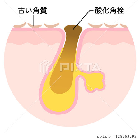 皮膚の構造 肌図 断面図のイラスト素材33029215- PIXTA