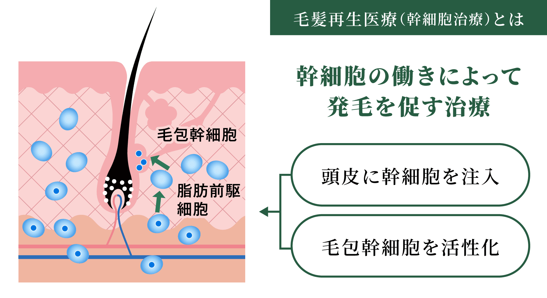 CPC毛髪再生プラス CPC-PRP®+セルブースターヘア 美容皮膚科 銀座よしえクリニック 公式 東京