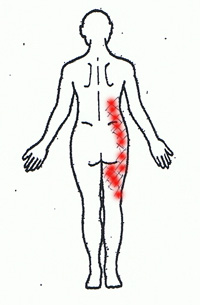 練馬区で帯状疱疹の治療ならサマンサクリニックおすすめ皮膚科