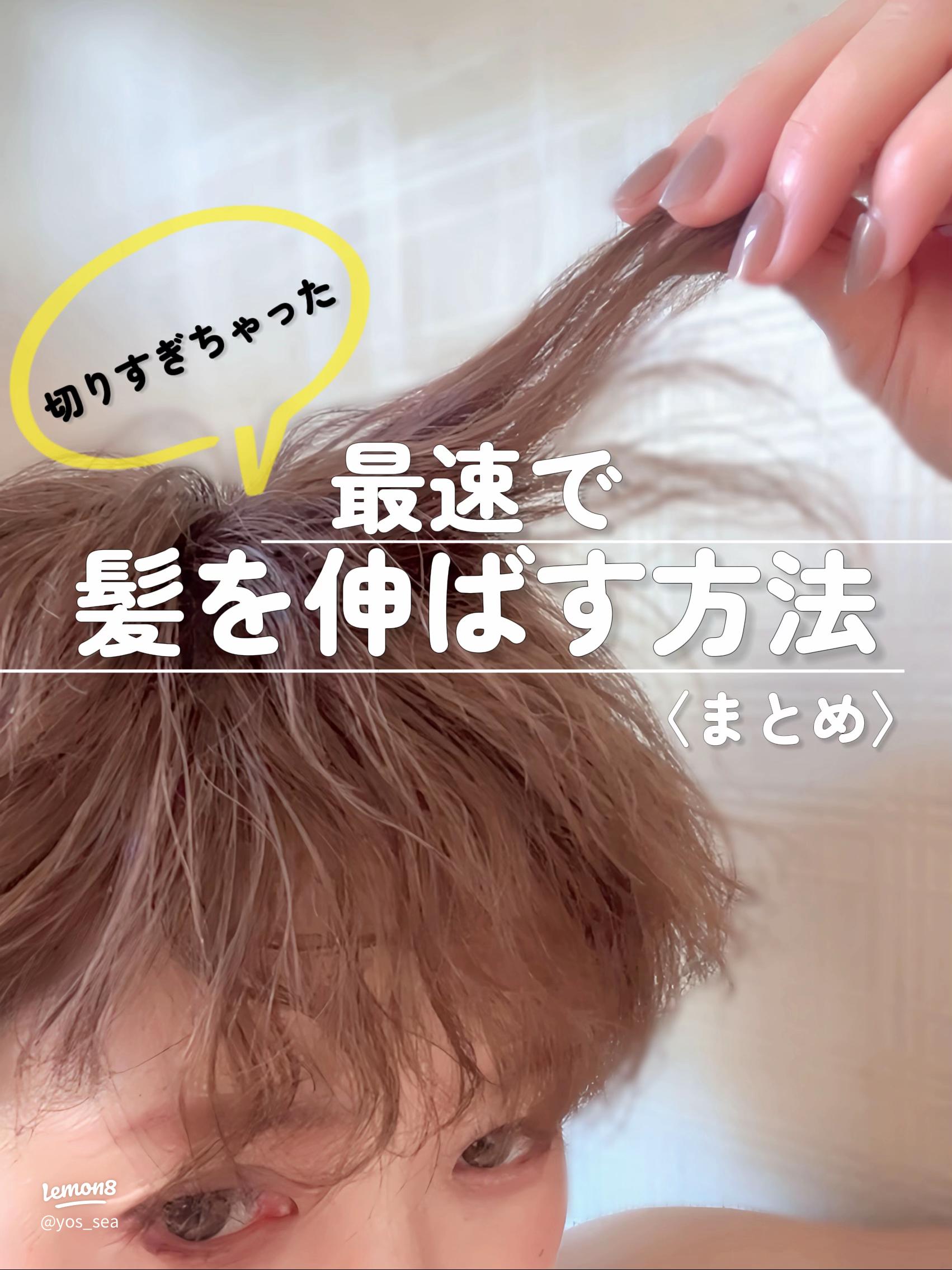 びまん性脱毛症とは？女性に多い脱毛症の原因と予防方法について解説 -公式 AGAスキンクリニックレディース