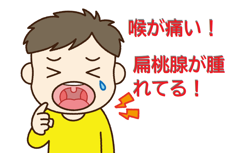 扁桃炎について池袋ながとも耳鼻咽喉科